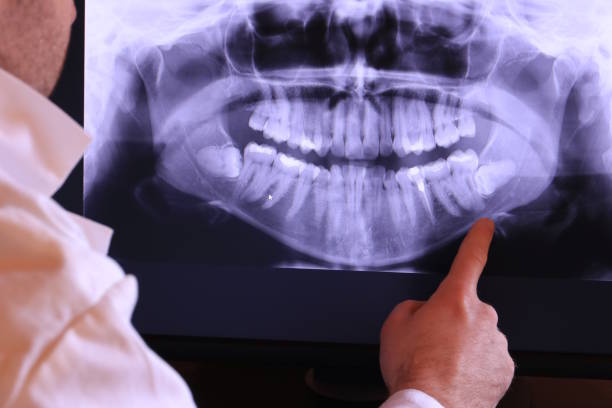 Best Mobile Emergency Dentist in Town Line, NY