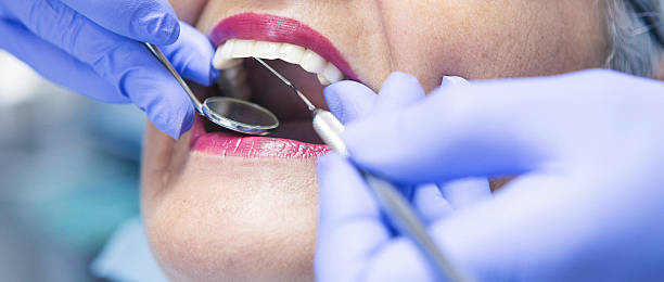 Best Emergency Dentist for Knocked-Out Tooth in Town Line, NY